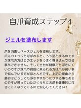 シュシュ(shou shou)/自爪育成　ステップ　４