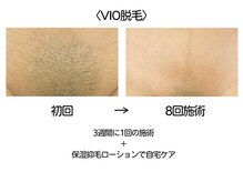 サロン ド クラール(salon de curar)の雰囲気（【50代・シミケア】肌育フェイシャル初回クーポンあり）