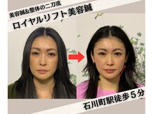 ハリカフェ(HARI CAFE)の雰囲気（美容鍼と整体でお身体全体を徹底的に調整します♪）