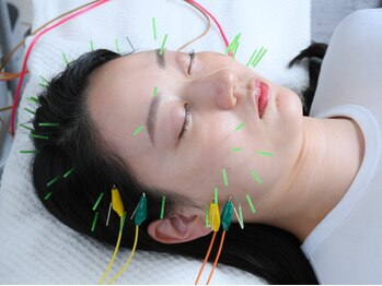 ハル(HALU)の写真/【なかもず駅徒歩3分】美容鍼×小顔矯正で理想のフェイスラインへ♪自分史上最高のすっきり感を今すぐ体験!