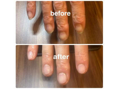 メンズネイルビズ 赤坂(Men's Nail Biz)の写真