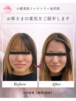 小顔美肌ファクトリー 金沢院の写真/骨格から整える“小顔専門”◇理学療法士監修の本格フェイスメイクサロン