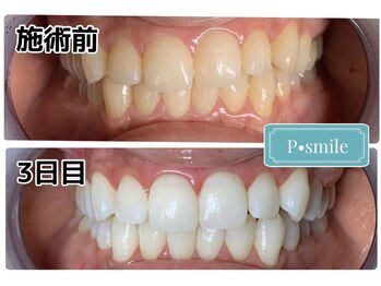 ピースマイル 札幌店(P Smile)