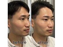 スター 新宿 新宿御苑(★STAR)/施術例メンズアイブロウWAX/新宿