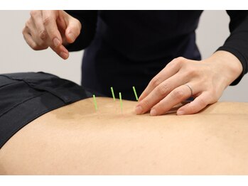 さくら整体院 屏風浦院/鍼灸施術で腰痛解消