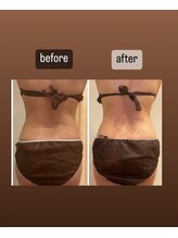 ララ(LALA)/痩身デトックスリンパマッサージ