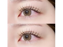 紫外線レスで負担軽減