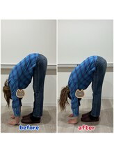 最後の整体 南郷18丁目駅院/腰痛でお悩みの方の可動域の変化