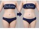 サロンドモフィ(salon de moffy)の写真/「最新脂肪冷却」×「脂肪燃焼剤同時使用」で気になる部分ケアから全身サイズダウンも◎近鉄四日市/痩身/四日市