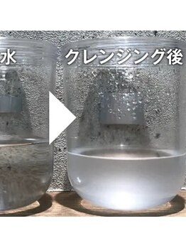 イリゼ(IRISE)/施術後のスッキリ肌に感動♪