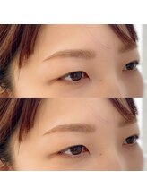 エル 薬院店(Eru)/ナチュラルアーチ