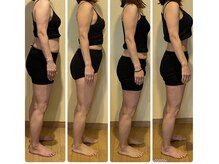 MKD/ダイエットコース