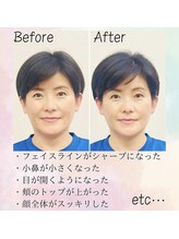 浜町アネックスあさひ整体院/【小顔整体】