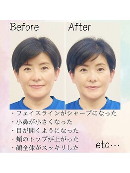 浜町アネックスあさひ整体院/【小顔整体】