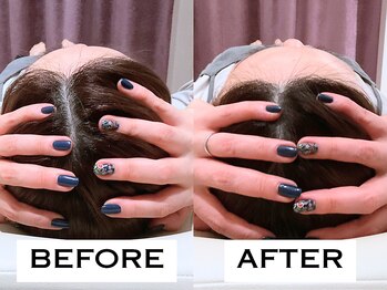 ビハリスト 麻布十番/頭のサイズからしっかり小顔に♪