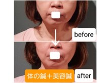 エルアンドエス(L&S)の雰囲気（たるみ・ほうれい線/短期集中でキープ！目の下のたるみ/クマ）