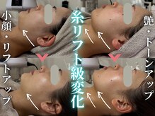 ハニエル(Haniel)の雰囲気（小顔・リフトアップしたい方必見☆驚愕レベルの結果をお届け♪♪）