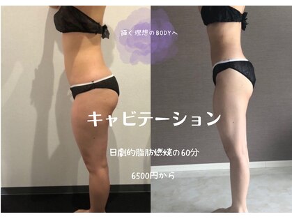 トータルビューティーサロンリア(Li'a)の写真