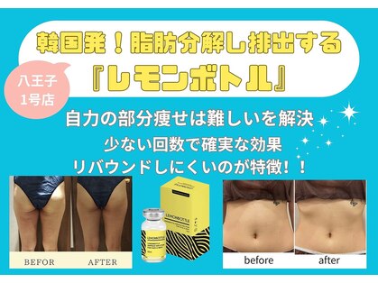 アンマンドの写真