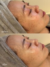 リュミエール(Lumie're)/オーナーの過去