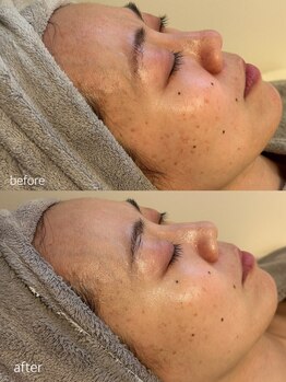 リュミエール(Lumie're)/オーナーの過去