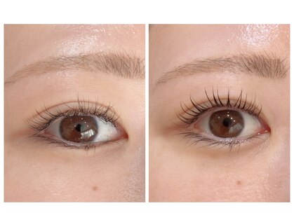 マックス(MAX)の写真