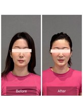 プライミー(PRIMY)/お得３点ビフォーアフター