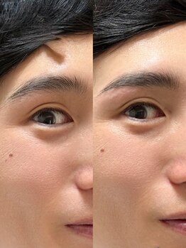 グッドインプレッション(Good impression)の写真/【男性にもオススメ！大歓迎★】眉毛デザインと眉の毛流れ矯正で、印象UP！清潔感もUP！