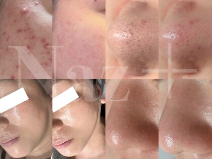 リベルテ(Liberte)の写真