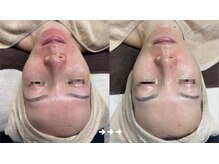 フロラスキン 上野店(florasKIN)/