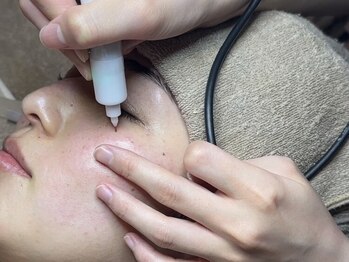 シミケア専門サロン Lotus. 千早香椎店【シミ/シワ/毛穴/小顔】の写真/【効果がなければ意味がない、本気の悩みワンランク上の専門ケア】お化粧いらずのお肌に☆初回¥8500