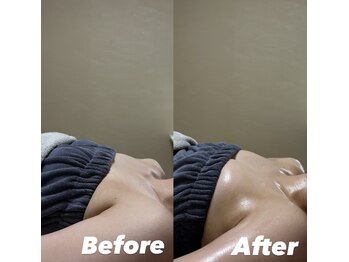 オンユ(Onyu)/ビフォーアフター4