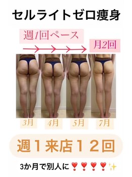 リミー(Re:Me)/40代〇〇さんの変化/週1来店