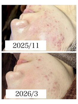 ブラックボックス(BLACK BOX)/20代女性のお客様