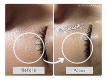 ルリアン(Lurian)/1回で変化！小じわのお悩みに！