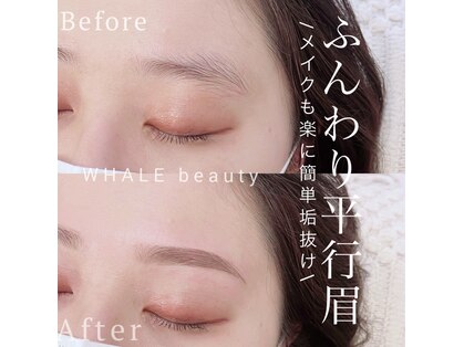 ウェイルビューティー(WHALE beauty)の写真
