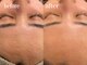 エンソワー(en'sower)の写真/産毛ケアなら女性専用シェービングエステへ。輝く肌で自信あふれる私に◎