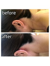 パーソナルエステティックサロン リボーン(ReBorn)/