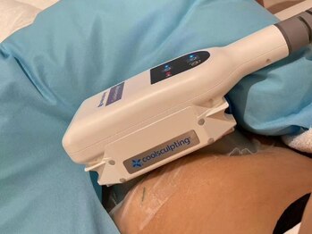 ヴェルデ 池袋西口店(Verde)/4カップ同時◎脂肪冷却