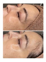 ラトナ(RATNA)/ララピール