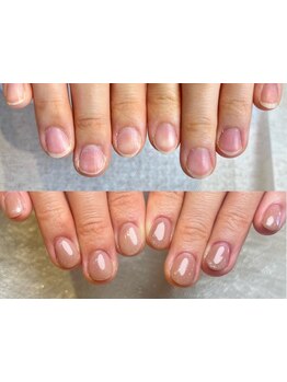 爪の悩みを解消できる（ケア含む）