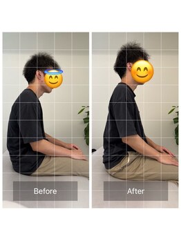 ナオル整体 恵比寿院(NAORU整体)/恵比寿/整体事例