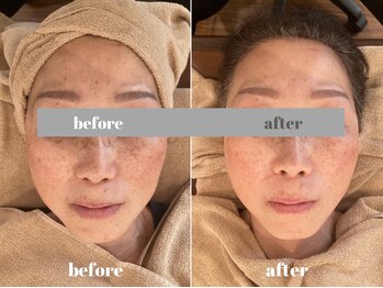 福多整体院/小顔美肌の即効性と持続力