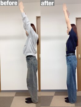 イロハ鍼灸整骨院 豊中市役所前院(IroHa鍼灸整骨院)/スタイルUP!理想の姿勢へ!