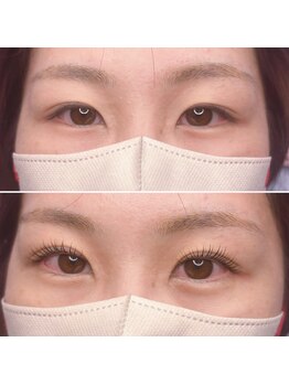 エンジェル(Angel)/マツパ