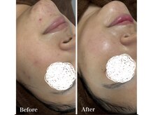 モエナ 武蔵小杉(Moena.)/肌質改善/幹細胞ハーブ