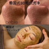 ミシェル(MICHELL)