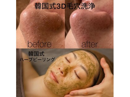 ミシェル(MICHELL)の写真