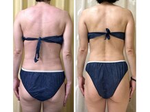 エイチラボ(H lab.)の雰囲気(温熱痩身で熱を練り込んで排出。むくみ無しスッキリボディへ♪)