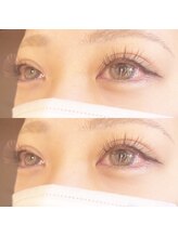 ビューティーホスピタル(Beauty Hospital)/ブラウンmix☆